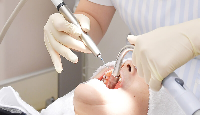 矯正治療開始前の虫歯・歯周病治療